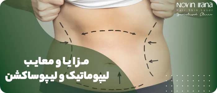 مزایا و معایب لیپوماتیک و لیپوساکشن